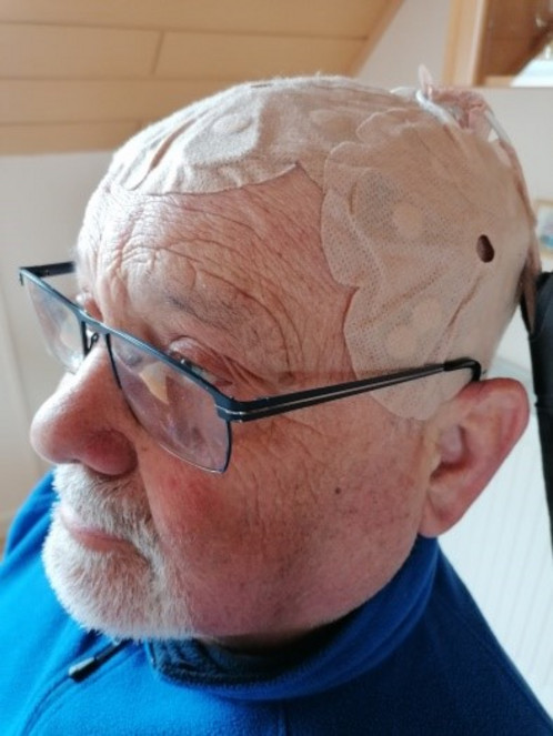 AiR - Eletroden am Kopf von Jürgen Schmidt Das Foto zeigt die Elektroden am Kopf von Jürgen Schmidt.